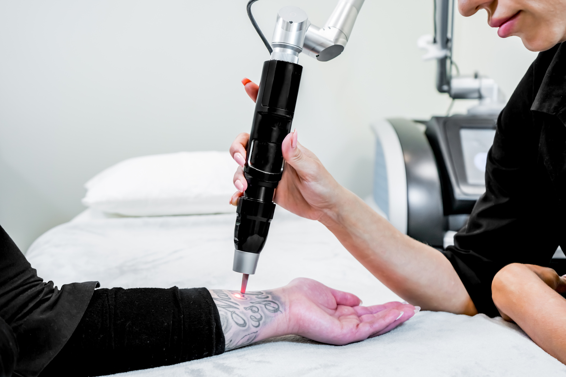 Laser tattoo removal of a large tattoo on a patient's arm, using picosecond laser technology, in a beauty and medical laser clinic. Technician is holding the hand piece.